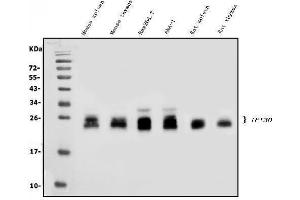Western blot analysis of GILT/IFI30 using anti-GILT/IFI30 antibody (ABIN7601299). (IFI30 Antikörper  (AA 32-248))