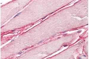 Image no. 2 for anti-Sarcoglycan, delta (35kDa Dystrophin-Associated Glycoprotein) (SGCD) (AA 244-256) antibody (ABIN1496154) (SGCD Antikörper  (AA 244-256))