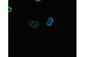 Immunofluorescent analysis of HepG2 cells using ABIN7157008 at dilution of 1:100 and Alexa Fluor 488-congugated AffiniPure Goat Anti-Rabbit IgG(H+L) (Inversin Antikörper  (AA 1-101))