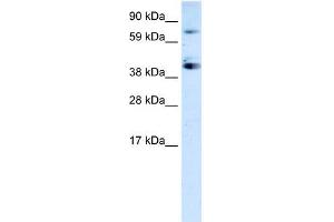 WB Suggested Anti-SP7 Antibody Titration:  0. (SP7 Antikörper  (C-Term))