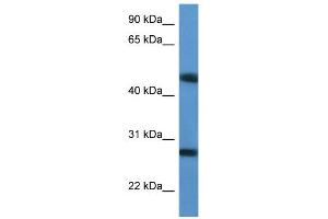 WB Suggested Anti-TM2D2 Antibody Titration: 0. (TM2D2 Antikörper  (Middle Region))
