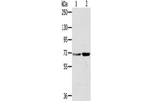 Western Blotting (WB) image for anti-Sorting Nexin 2 (SNX2) antibody (ABIN2427293) (Sorting Nexin 2 Antikörper)
