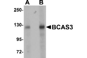 Western Blotting (WB) image for anti-Breast Carcinoma Amplified Sequence 3 (BCAS3) (N-Term) antibody (ABIN1031263) (BCAS3 Antikörper  (N-Term))