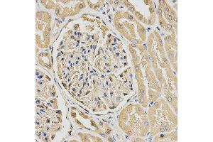Immunohistochemistry (IHC) image for anti-HUS1 Checkpoint Homolog (S. Pombe) (HUS1) antibody (ABIN1876595) (HUS1 Antikörper)