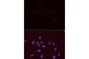 Immunofluorescence (IF) image for anti-Amyloid beta (A4) Precursor-Like Protein 2 (APLP2) antibody (ABIN1876643) (APLP2 Antikörper)