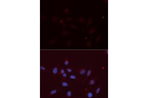 Immunofluorescence (IF) image for anti-Amyloid beta (A4) Precursor-Like Protein 2 (APLP2) antibody (ABIN1876643) (APLP2 Antikörper)