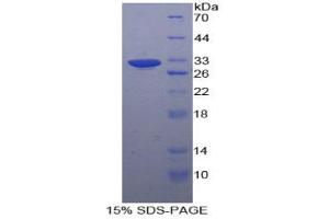 SDS-PAGE analysis of Human ALDOA Protein. (ALDOA Protein)