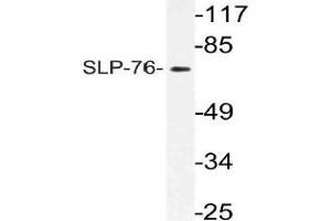 Western blot (WB) analysis of SLP-76 antibody in extracts from Jurkat cells.