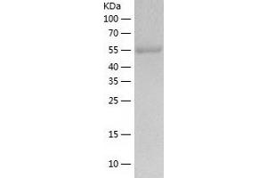 Western Blotting (WB) image for Aldehyde Dehydrogenase 2 Family (Mitochondrial) (ALDH2) (AA 20-519) protein (His tag) (ABIN7286220) (ALDH2 Protein (AA 20-519) (His tag))