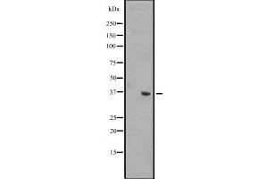 Western Blotting (WB) image for anti-Wingless-Type MMTV Integration Site Family, Member 8B (WNT8B) (Internal Region) antibody (ABIN6258647)