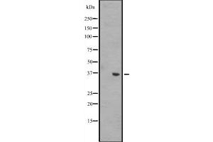 Western blot analysis of WNT8B expression in A431 whole cell lysate ,The lane on the left is treated with the antigen-specific peptide.