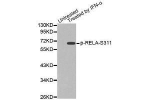 Western blot analysis of extracts from Hela cells, using Phospho-RELA-S311 antibody. (NF-kB p65 Antikörper  (pSer311))
