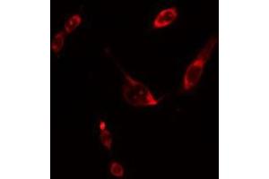 ABIN6275599 staining Hela cells by IF/ICC. (SOS2 Antikörper  (Internal Region))