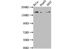 Western Blot Positive WB detected in: Hela whole cell lysate, HepG2 whole cell lysate, 293T whole cell lysate All lanes: C4A antibody at 3. (C4A Antikörper  (AA 1027-1186))