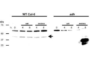 Western Blotting (WB) image for anti-Alcohol Dehydrogenase (ADH) antibody (ABIN619537)