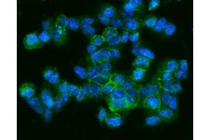 IF analysis of CD9 using anti-CD9 antibody (ABIN4886531).
