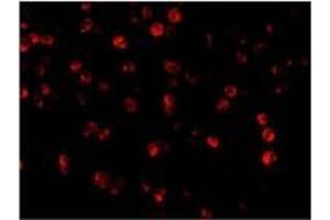 AP20057PU-N Beclin-1 antibody staining of A431 cells by Immunofluorescence at 2 μg/ml. (Beclin 1 Antikörper  (C-Term))