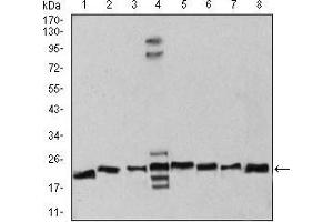 Western Blotting (WB) image for anti-RAN, Member RAS Oncogene Family (RAN) (AA 1-216) antibody (ABIN5876159)