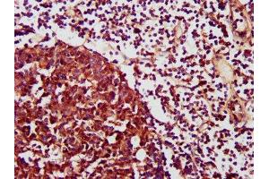 Immunohistochemistry (IHC) image for anti-Chemokine (C-X-C Motif) Receptor 3 (CXCR3) (AA 4-50) antibody (ABIN7146103)