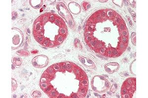 Human Kidney: Formalin-Fixed, Paraffin-Embedded (FFPE). (TMPRSS4 Antikörper  (AA 71-120))