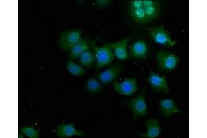 Immunofluorescence staining of A549 cells with ABIN7146877 at 1:50, counter-stained with DAPI. (CSNK1G3 Antikörper  (Isoform gamma 3))