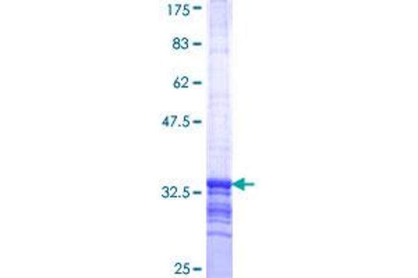 HEL308 Protein (AA 275-337) (GST tag)