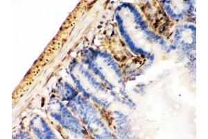 IHC testing of FFPE mouse intestinal cancer with Galectin 1 antibody.