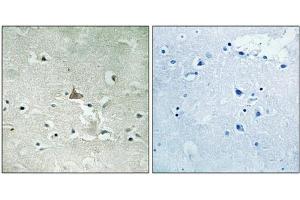Immunohistochemical analysis of paraffin-embedded human brain tissue using Trk B (Phospho-Tyr706/Tyr707) antibody (left)or the same antibody preincubated with blocking peptide (right). (TRKB Antikörper  (pTyr706, pTyr707))