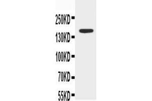 Anti-ABCB4 antibody, Western blotting WB: MCF-7 Cell Lysate (ABCB4 Antikörper  (N-Term))