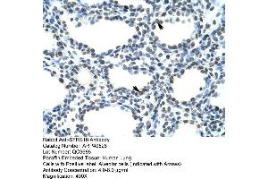 Rabbit Anti-SFRS10 Antibody  Paraffin Embedded Tissue: Human Lung Cellular Data: Alveolar cells Antibody Concentration: 4. (TRA2B Antikörper  (N-Term))