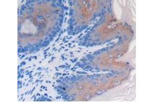 IHC-P analysis of Mouse Esophagus Tissue, with DAB staining. (LRG1 Antikörper  (AA 136-342))