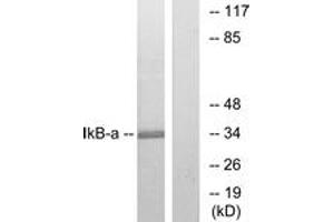 Western blot analysis of extracts from MCF7 cells, treated with TNF-alpha, using IkappaB-alpha (Ab-32/36) Antibody. (NFKBIA Antikörper  (AA 15-64))