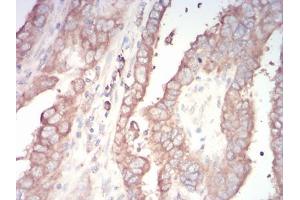 Immunohistochemistry (IHC) image for anti-Transcription Factor AP-2 alpha (Activating Enhancer Binding Protein 2 Alpha) (TFAP2A) (AA 1-100) antibody (ABIN5542420)