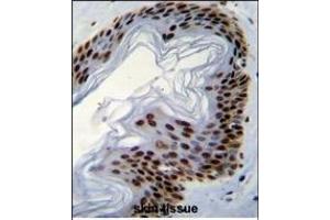 IFI35 Antibody (N-term R30) (ABIN655077 and ABIN2844709) immunohistochemistry analysis in formalin fixed and paraffin embedded human skin tissue followed by peroxidase conjugation of the secondary antibody and DAB staining. (IFI35 Antikörper  (N-Term))