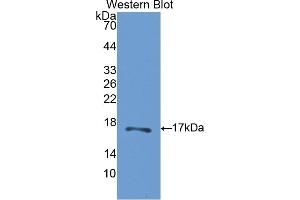 Western blot analysis of the recombinant protein. (CA5B Antikörper  (AA 174-311))