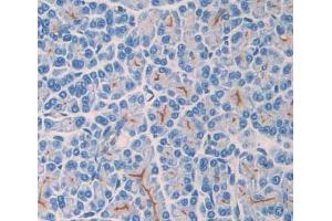 Used in DAB staining on fromalin fixed paraffin- embedded pancreas tissue (TLR3 Antikörper  (AA 381-699))