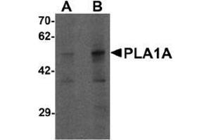 Western blot analysis of PLA1A in human kidney tissue lysate with PLA1A antibody at (A) 1 and (B) 2 ug/mL.
