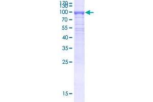 KLHL21 Protein (AA 1-597) (GST tag)