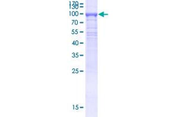 KLHL21 Protein (AA 1-597) (GST tag)