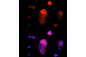 Immunofluorescence analysis of MCF7 cells using AAMP Rabbit mAb (ABIN7265584) at dilution of 1:25 (40x lens).