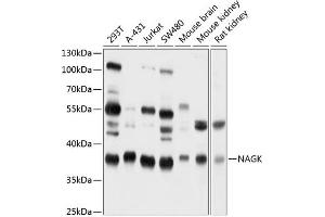 Western blot analysis of extracts of various cell lines, using NAGK antibody (ABIN6130569, ABIN6144344, ABIN6144345 and ABIN6224883) at 1:1000 dilution. (NAGK Antikörper  (AA 50-210))