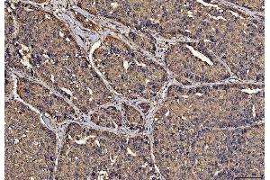 IHC analysis of PDIA6 using anti-PDIA6 antibody (ABIN7600554). (PDIA6 Antikörper  (AA 20-440))