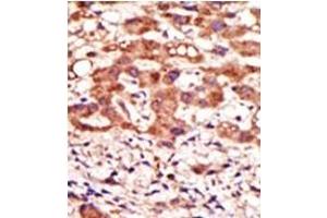 Image no. 2 for anti-Mannosyl (Alpha-1,3-)-Glycoprotein beta-1,2-N-Acetylglucosaminyltransferase (MGAT1) (N-Term) antibody (ABIN357694) (MGAT1 Antikörper  (N-Term))