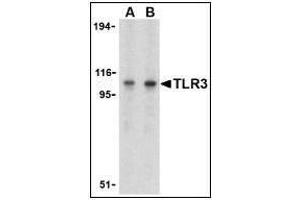 Western blot analysis of TLR3 in Daudi cell lysate with TLR3 antibody at (A) 1 and (B) 2 µg/ml.
