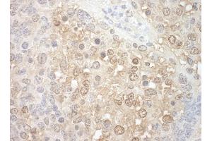Immunohistochemistry (IHC) image for anti-Tuftelin Interacting Protein 11 (TFIP11) (AA 1-50) antibody (ABIN7448831) (TFIP11 Antikörper  (AA 1-50))