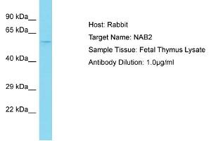 Host: Rabbit Target Name: NAB2 Sample Tissue: Human Fetal Thymus Antibody Dilution: 1ug/ml (NAB2 Antikörper  (N-Term))