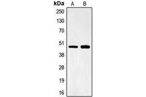 Western blot analysis of FOXB2 expression in Lovo (A), HeLa (B) whole cell lysates.