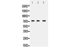 Anti- ABCG5 Picoband antibody, Western blotting All lanes: Anti ABCG5  at 0. (ABCG5 Antikörper  (N-Term))