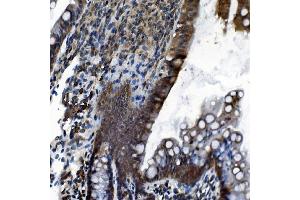 IHC analysis of CDC27 using anti-CDC27 antibody (ABIN7602163). (CDC27 Antikörper  (AA 609-824))