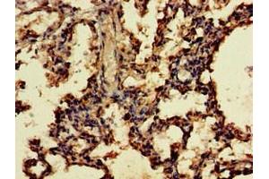 Immunohistochemistry of paraffin-embedded human lung tissue using ABIN7166249 at dilution of 1:100 (UNC13D Antikörper  (AA 7-172))